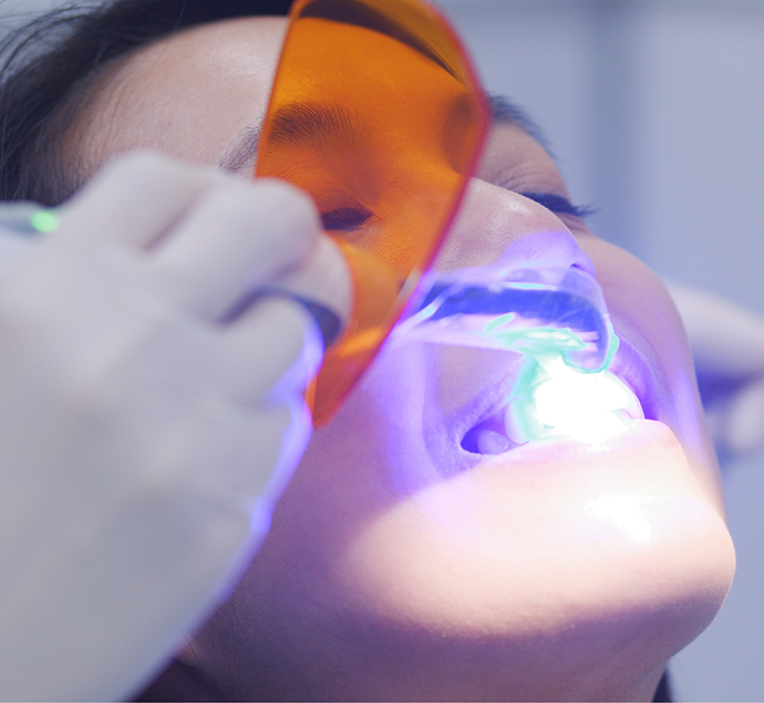 Dental patient having an ultraviolet light applied to her teeth by her cosmetic dentist