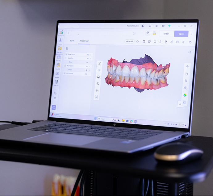 Computer screen showing a digital model of a patients teeth
