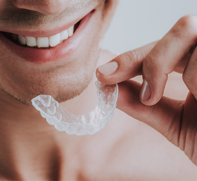 Man holding a clear nightguard tray near his smile