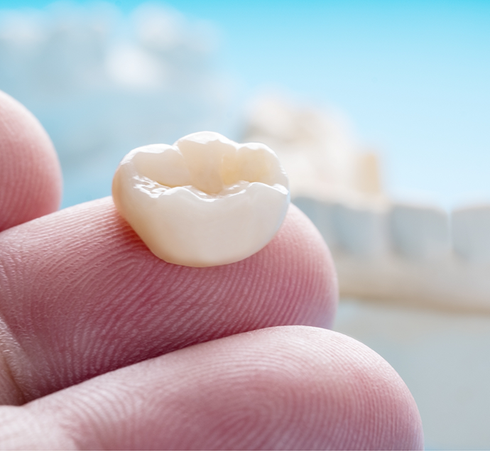 Close up of a dental crown resting on a finger