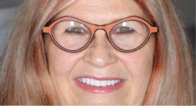 Woman smiling with white evenly aligned teeth