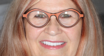 Woman smiling with white evenly aligned teeth