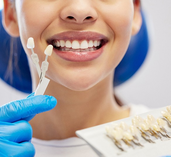 Nose-to-neck view of woman smiling with gloved hand holding shade guide to her teeth
